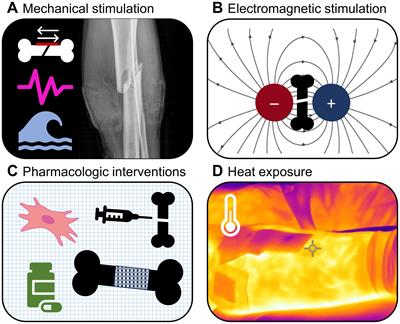 Methods to accelerate fracture healing – a narrative review from a clinical perspective
